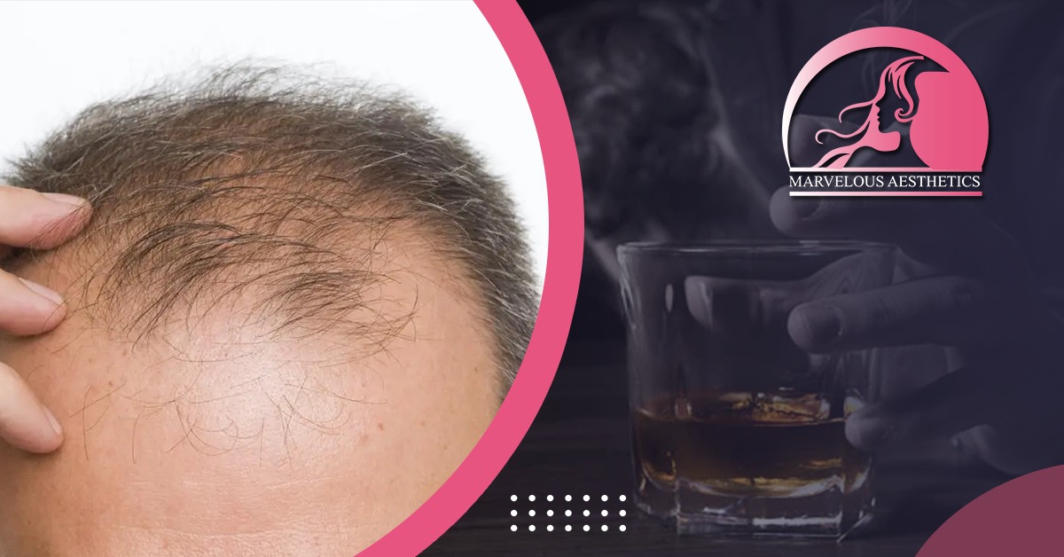 Can Drinking and Smoking Cause Hair Loss Problems?